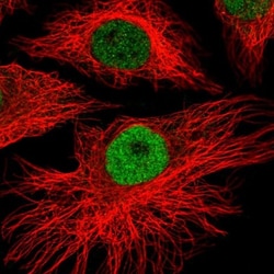 MEIS1 Antibody, Novus Biologicals 0.1mL; Unlabeled:Antibodies, Polyclonal